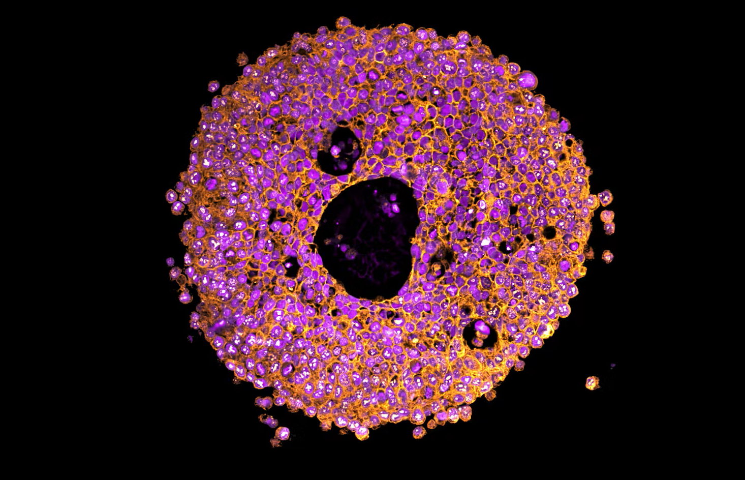 3D Bioprinted Organoids for Drug Screening: Advancing Pregnancy Research